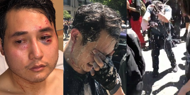 andy-ngo-assaulted-by-antifa.jpg