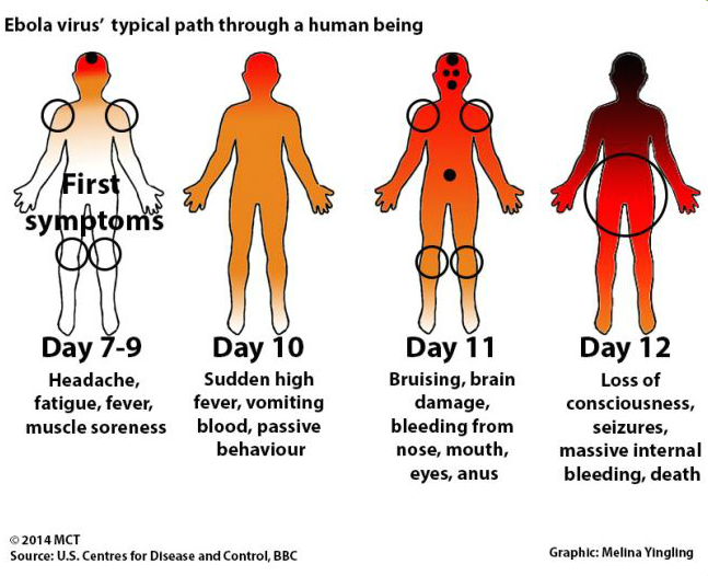 ebola-symptom-progression.png