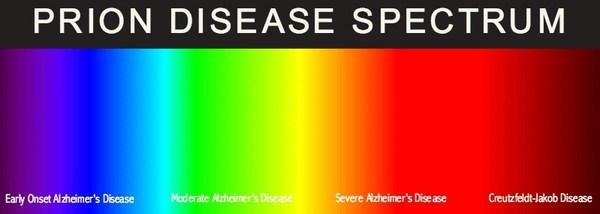 prion_disease_spectrum.jpg