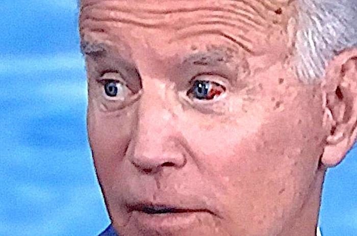 Joe-Biden-bloody-eye.jpg