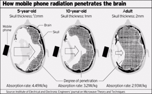 cell_radiation_brain.gif