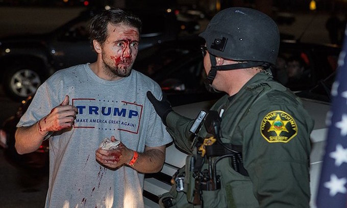 trump_supporter_bloody.jpg